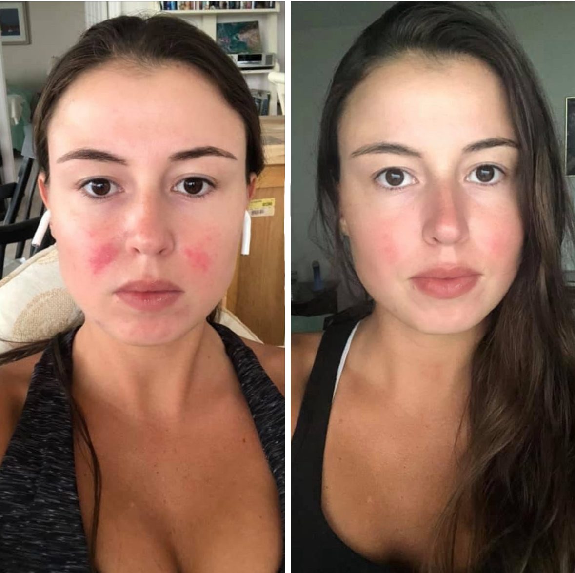 Elivae customer, before and night 63, unretouched